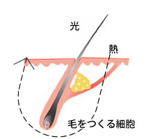 レーザー効果の仕組み